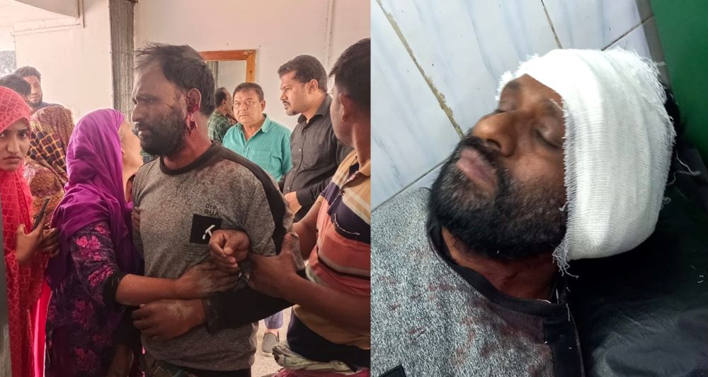 পাবনায় মারামারি করতে গিয়ে কান কাটা পড়লো